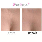 SkinFace™ - Adesivos de Silicone Rejuvenescedor Anti Rugas - True Inovare